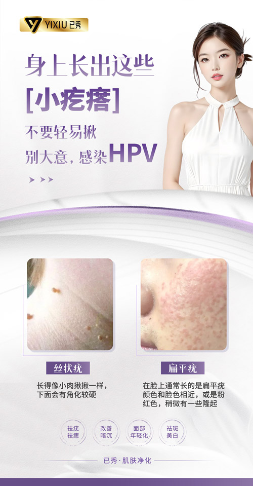 已秀减肥的合作 顽固性肥胖怎么减肥